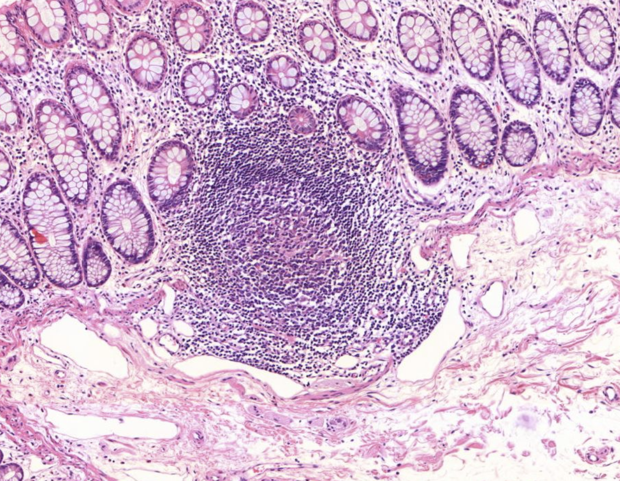 Histopathologisches Bild: Kolonschleimhaut